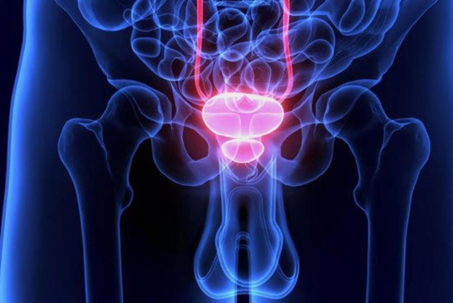 EuropaPress. Un diagnóstico precoz es la clave para curarse del cáncer de próstrata EuropaPress. Un diagnóstico precoz es la clave para curarse del cáncer de próstrata