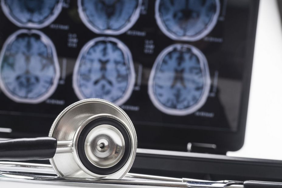 Imagen de una resonancia magnética cerebral. (Bigstock) Imagen de una resonancia magnética cerebral. (Bigstock)