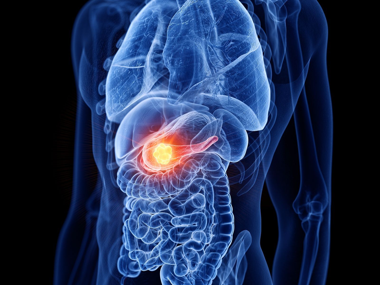 Los cambios en la dieta, ¿pueden ayudar a prevenir el cáncer de páncreas? (Bigstock) Los cambios en la dieta, ¿pueden ayudar a prevenir el cáncer de páncreas? (Bigstock)