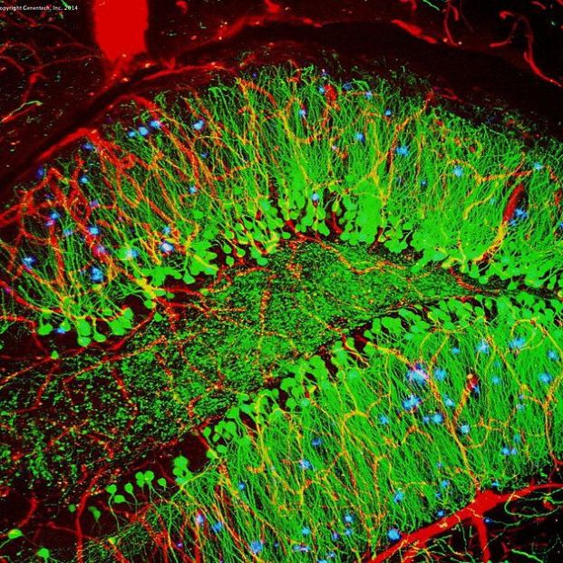 Esta exploración del cerebro de un ratón muestra vasos sanguíneos (rojo), células cerebrales (verde) y placas amiloides (azul). . Centro Nacional para el Avance de las Ciencias Traslacionales. Esta exploración del cerebro de un ratón muestra vasos sanguíneos (rojo), células cerebrales (verde) y placas amiloides (azul). . Centro Nacional para el Avance de las Ciencias Traslacionales.