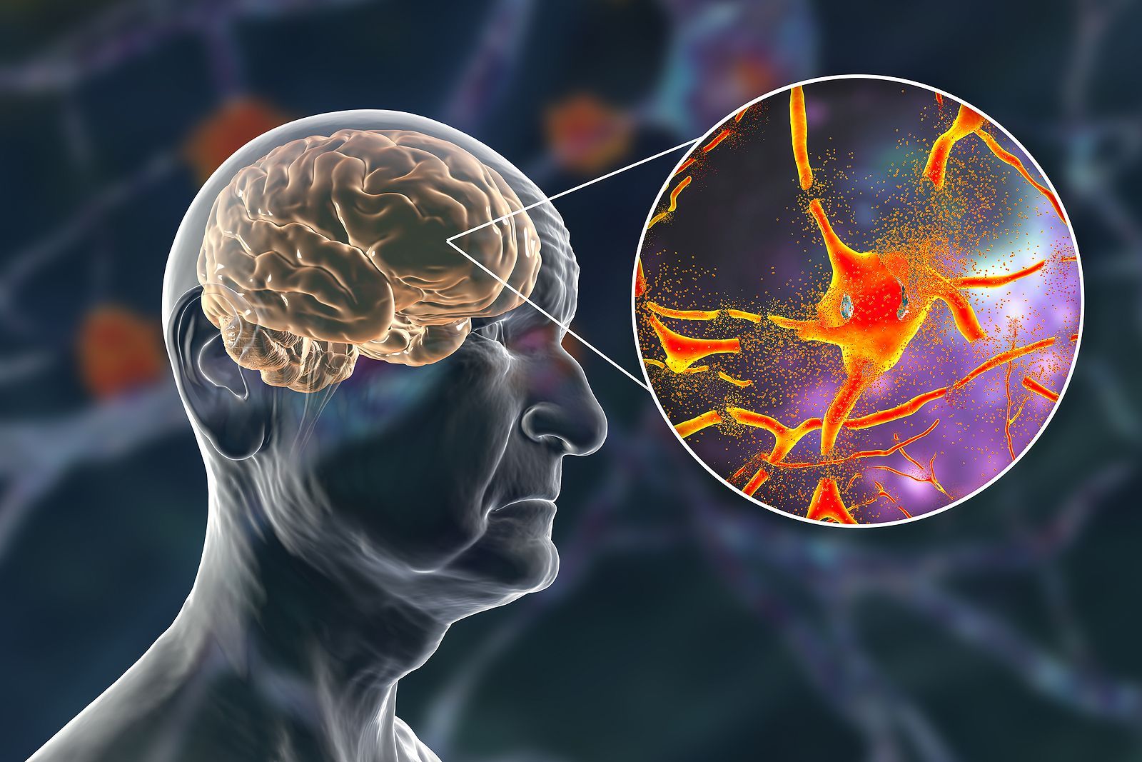 El papel protector de las moléculas de azúcar contra el envejecimiento cerebral (Bigstock)