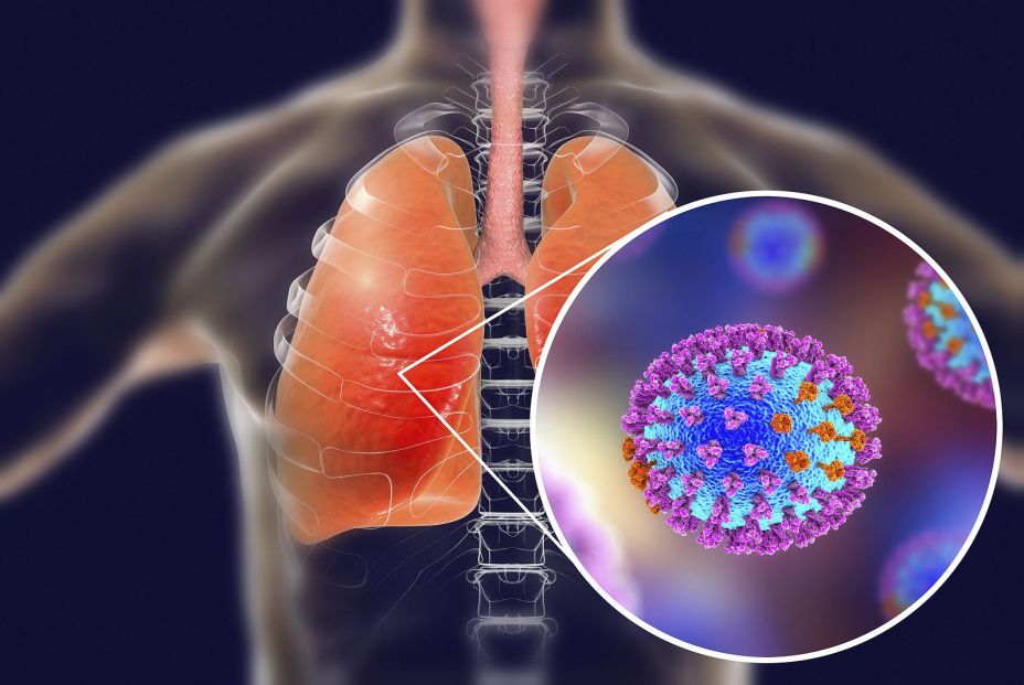 bigstock Flu Viruses In Human Lungs d 232827346 bigstock Flu Viruses In Human Lungs d 232827346