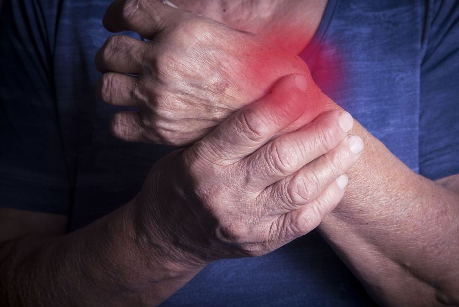 bigstock Hand Deformed From Rheumatoid 103232228 bigstock Hand Deformed From Rheumatoid 103232228