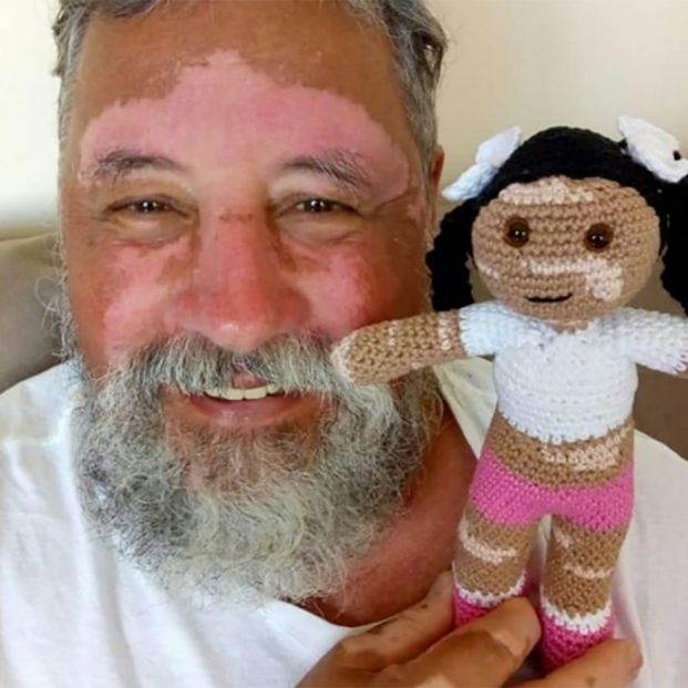 Un abuelo brasileño crea una muñeca inclusiva con vitíligo para su nieta