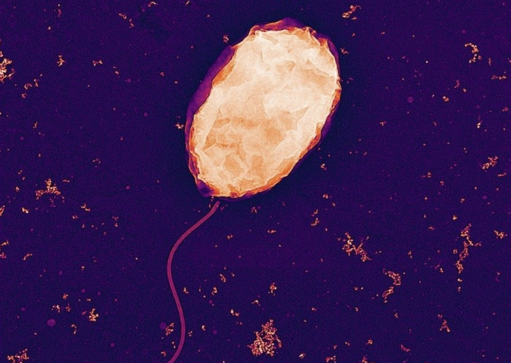 Alertan del riesgo de infecciones por 'Vibrio' durante el verano: síntomas y cómo prevenir