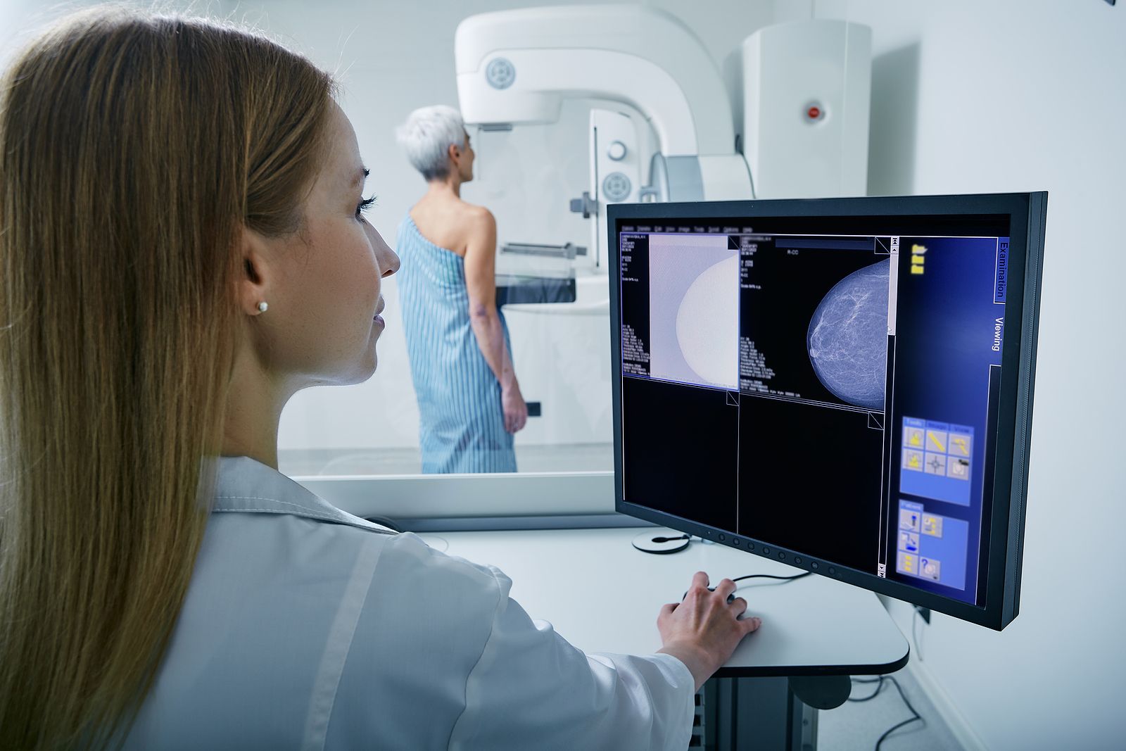 Identifican cambios genéticos que permiten predecir la respuesta al tratamiento de cáncer de mama