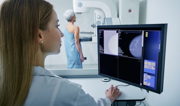 Identifican biomarcadores que anticipan la eficacia del tratamiento en el cáncer de mama