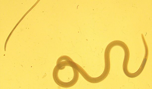 Descubren qué parte hay que quitarle al pescado para evitar el riesgo de anisakis