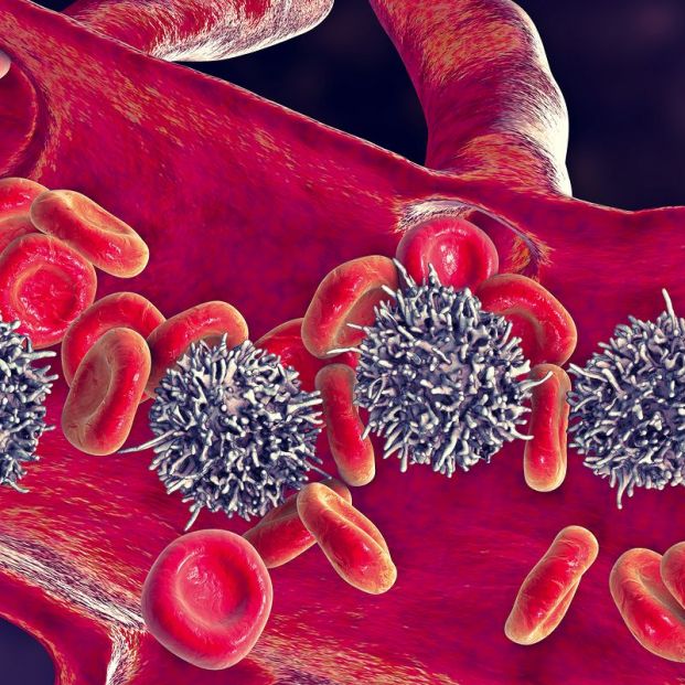 Investigadores españoles descifran la predisposición genética a la leucemia linfática