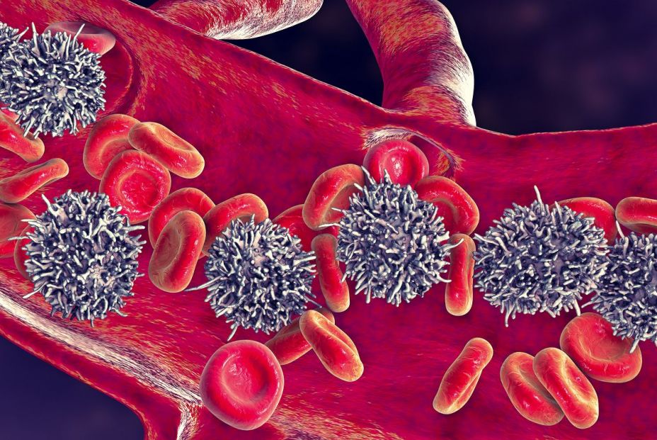 Investigadores españoles descifran la predisposición genética a la leucemia linfática