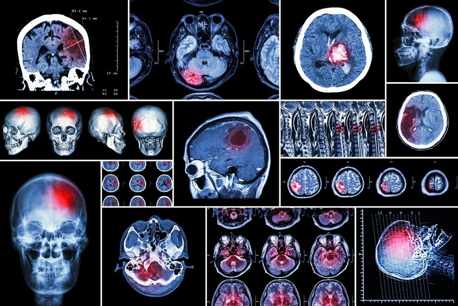 bigstock Set Collection Of Brain Dise 106060739 bigstock Set Collection Of Brain Dise 106060739