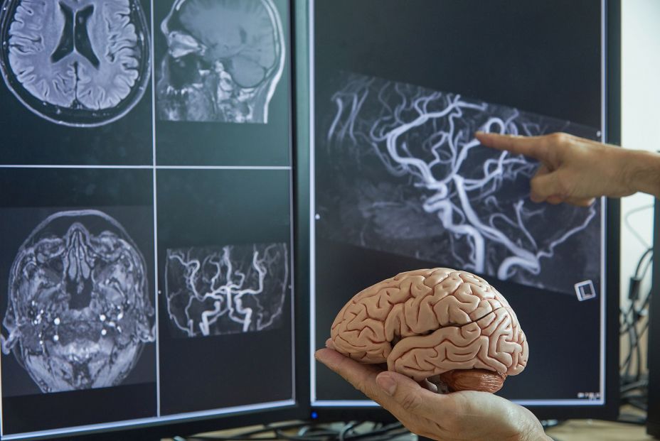 bigstock Human Brain Model On Doctor Ha 260785804 bigstock Human Brain Model On Doctor Ha 260785804