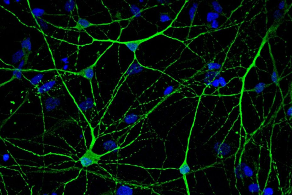 EuropaPress 6358843 neuronas generadas partir celulas madre paciente alzheimer EuropaPress 6358843 neuronas generadas partir celulas madre paciente alzheimer