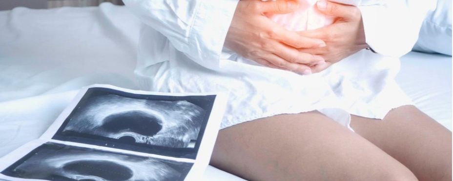 europapress 3621574 endometriosis europapress 3621574 endometriosis