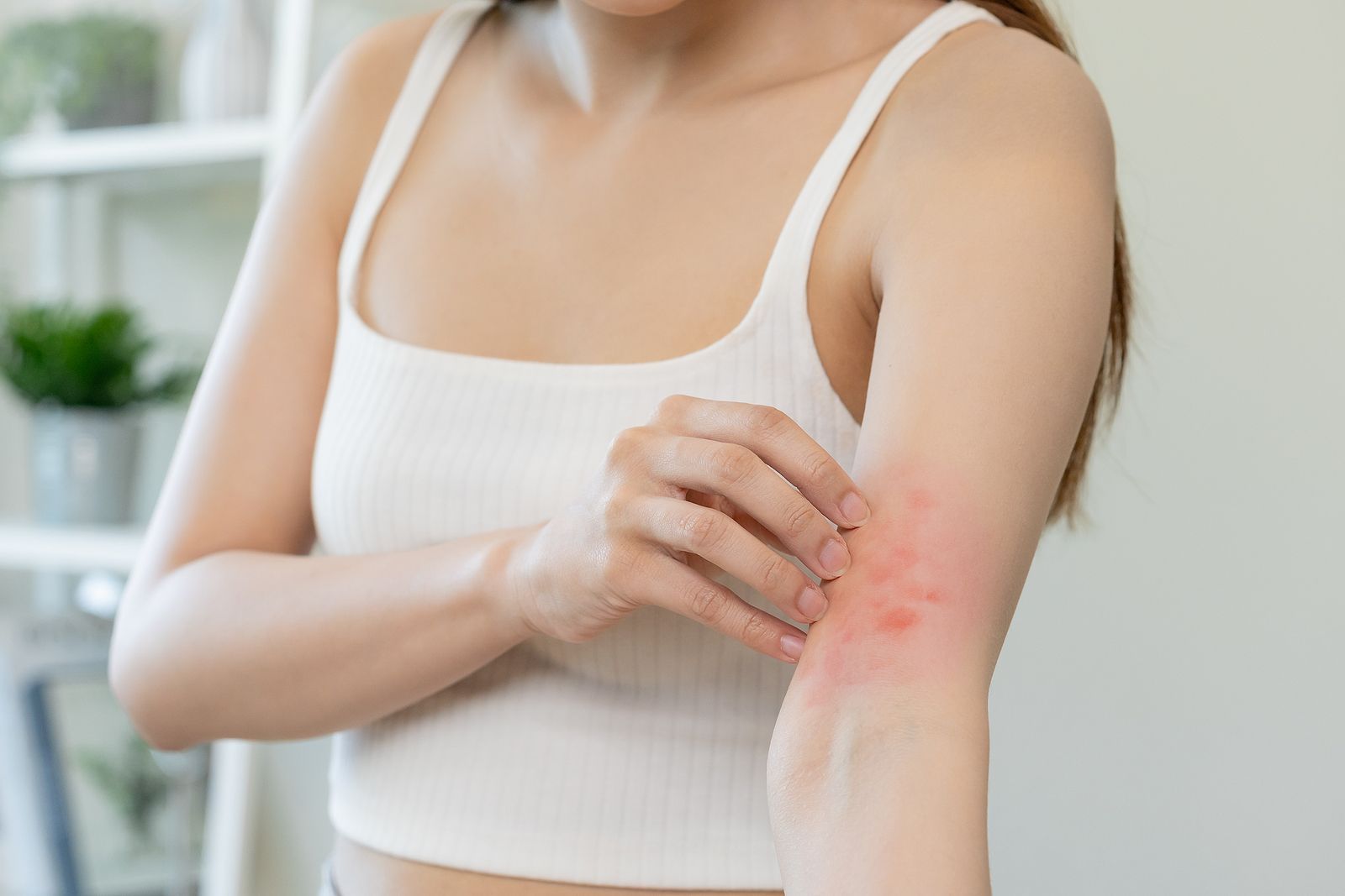 ¿Realmente funcionan los sticks o productos postpicaduras que prometen aliviar el picor?
