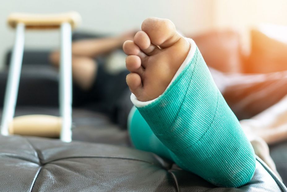 bigstock Bone Fracture Foot And Leg On  308123317