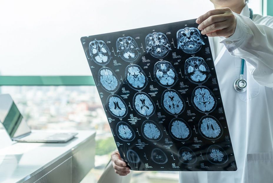 bigstock Brain Disease Diagnosis With M 328571143 bigstock Brain Disease Diagnosis With M 328571143