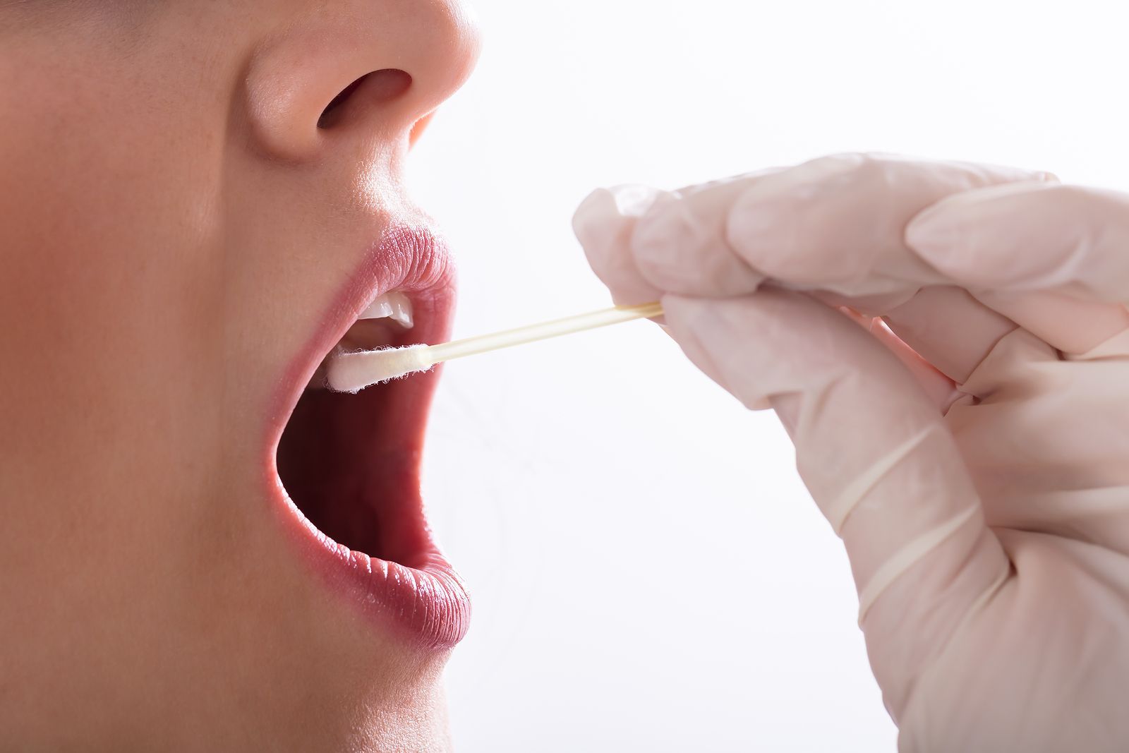 ¿Un test de saliva para detectar precozmente la obesidad y la diabetes? (Bigstock) ¿Un test de saliva para detectar precozmente la obesidad y la diabetes? (Bigstock)