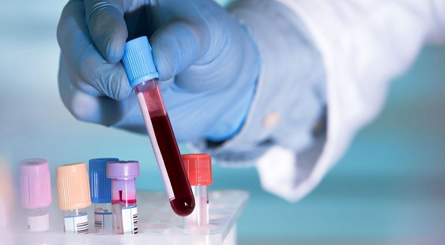 Los parámetros que no debes ignorar en tu análisis de sangre: estos errores arruinarán el resultado