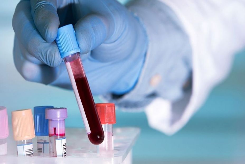 Descubren por qué un cáncer de la sangre es más letal en mujeres Descubren por qué un cáncer de la sangre es más letal en mujeres