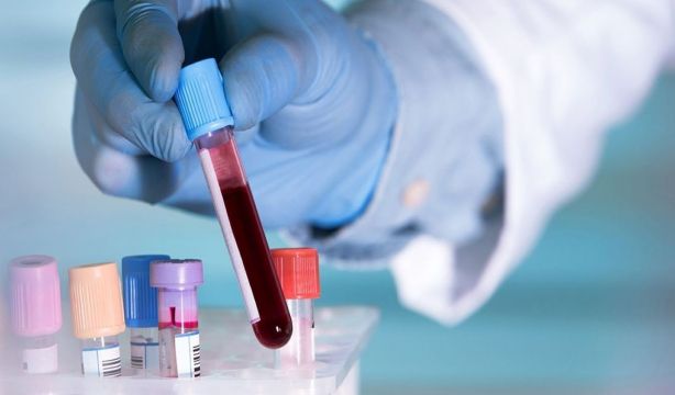 Descubren por qué un cáncer de la sangre es más letal en mujeres