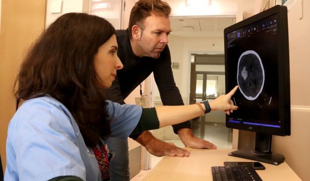 Caídas en mayores: la warfarina no aumenta el riesgo de hemorragia cerebral tras un traumatismo