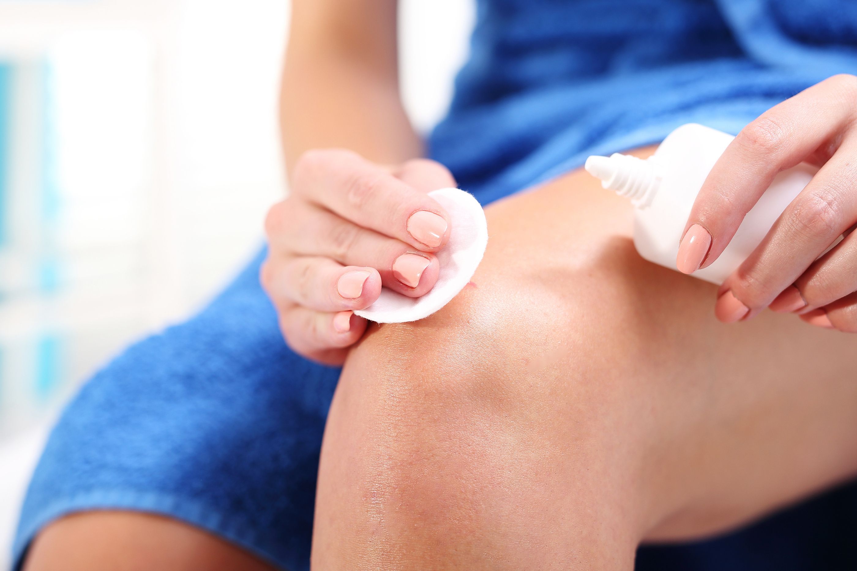 Alerta sanitaria retiran varios productos contra las quemaduras y heridas por riesgo de infección