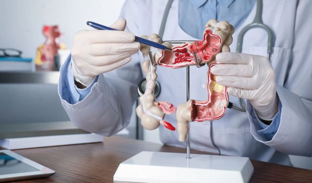 La vitamina C podría reducir la resistencia del cáncer colorrectal a quimioterapia