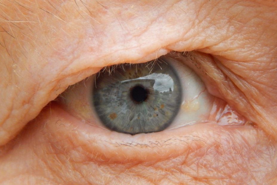 CEOMA apoya ‘Objetivo DMAE’ para mejorar la calidad de vida de los mayores con degeneración macular CEOMA apoya ‘Objetivo DMAE’ para mejorar la calidad de vida de los mayores con degeneración macular