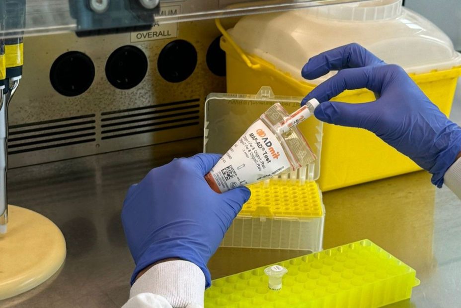 Desarrollan el primer biomarcador en sangre que anticipa el avance del alzhéimer