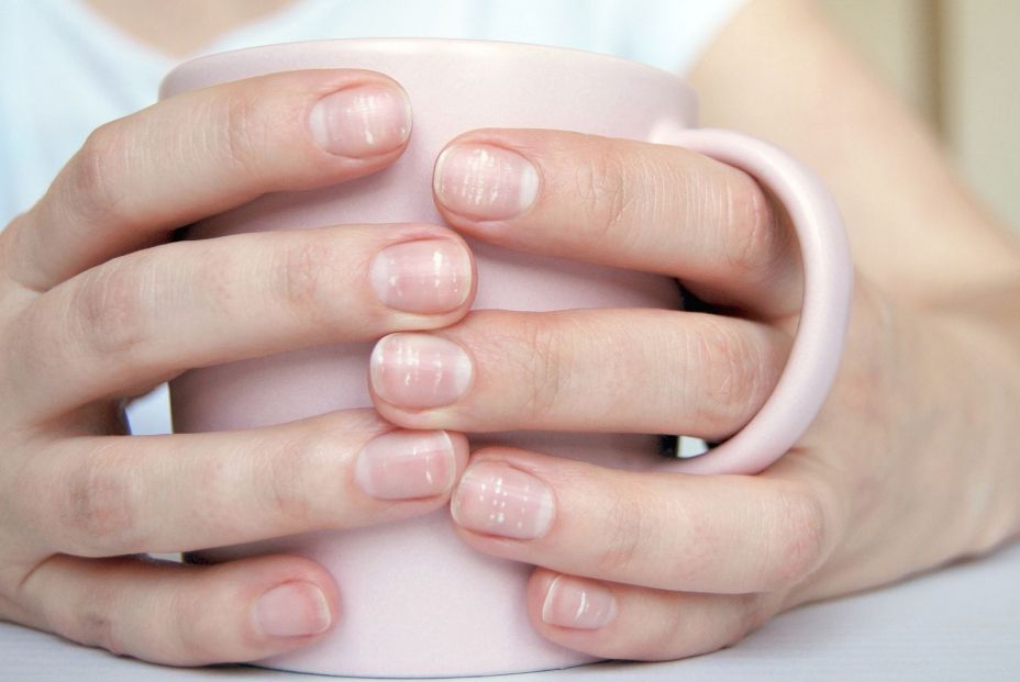 bigstock Many White Spots On Fingernail 345530284