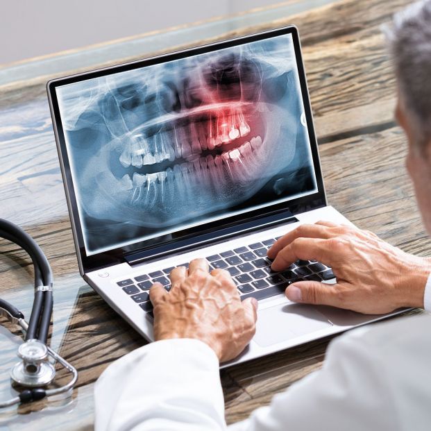 Los mayores a los que les faltan dientes pueden tener más riesgo de una enfermedad cardiovascular