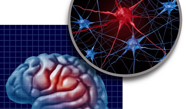 Un estudio relaciona la dificultad de movimiento en párkinson con cambios en el córtex cerebral