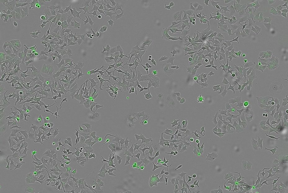 Descubren un mecanismo bacteriano capaz de destruir células tumorales Descubren un mecanismo bacteriano capaz de destruir células tumorales