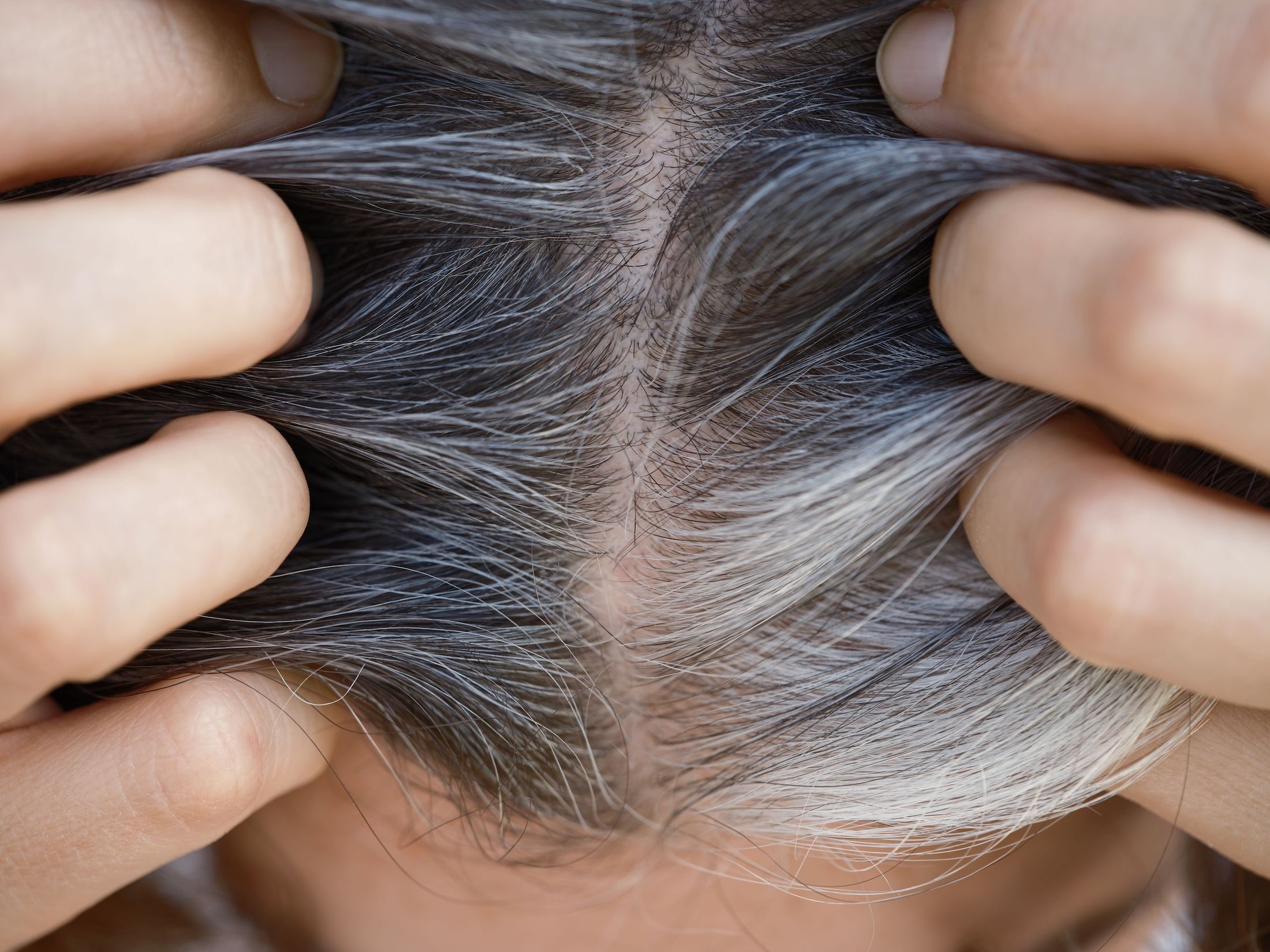 El sorprendente vínculo entre las canas y la protección contra el cáncer El sorprendente vínculo entre las canas y la protección contra el cáncer