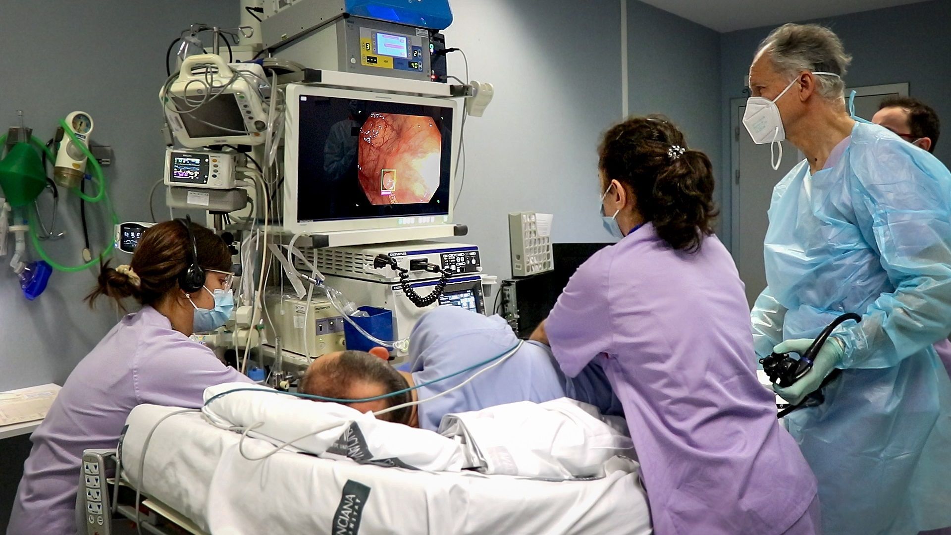 El tiempo medio de espera para una colonoscopia asciende a 158 días en la sanidad pública. Europa Press