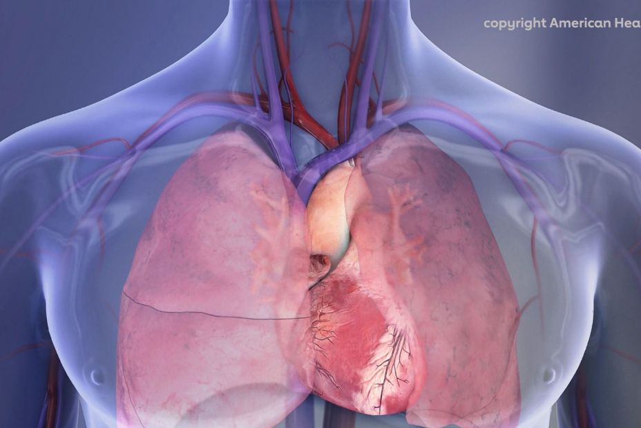 Ensayan una técnica innovadora para el corazón que salvaría a pacientes sin opciones de tratamiento