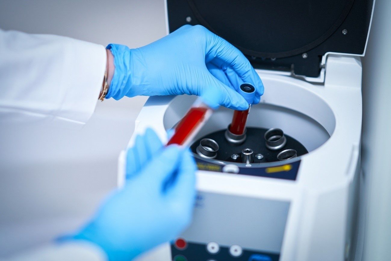 Un análisis de sangre podría detectar el párkinson antes de los primeros síntomas. Foto: Europa Press