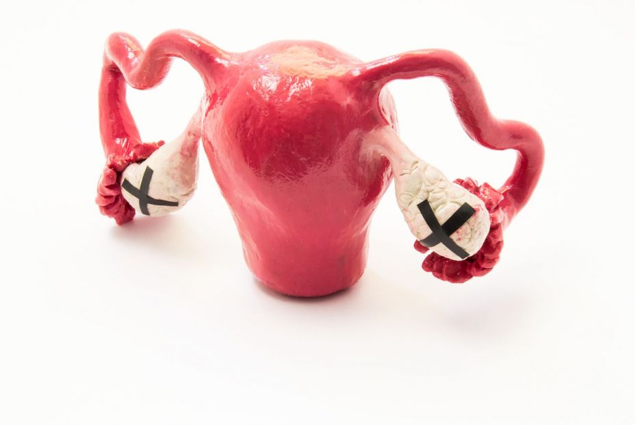 La esperanza de las pacientes con cáncer de ovario se fija en estos nuevos fármacos