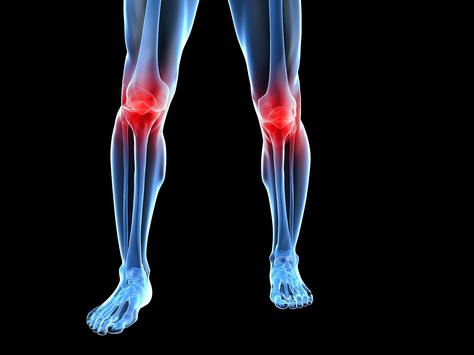 El ejercicio realizado en casa reduce el dolor de rodilla. Foto: Bigstock.