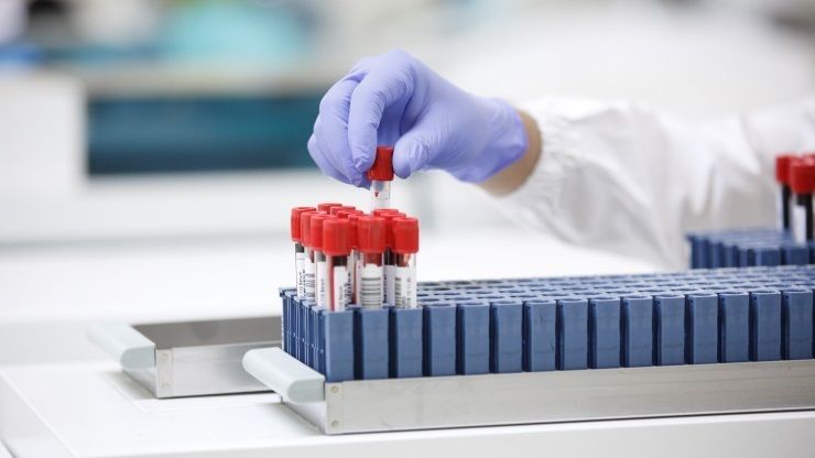 Biopsia líquida. Fuente: ROCHE / Europa Press.