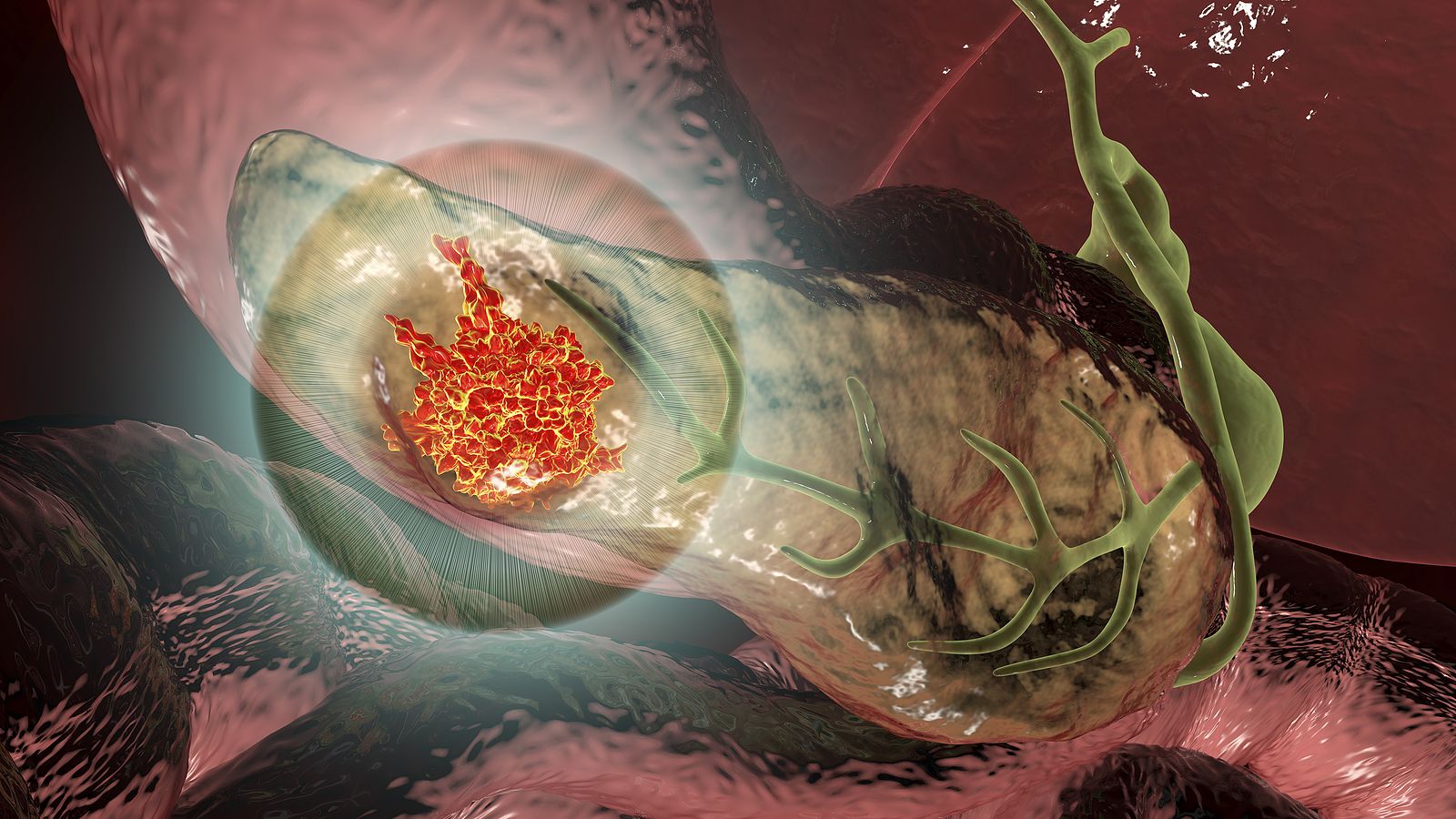 Una investigación del CNIO halla nuevos genes que predisponen al cáncer de páncreas