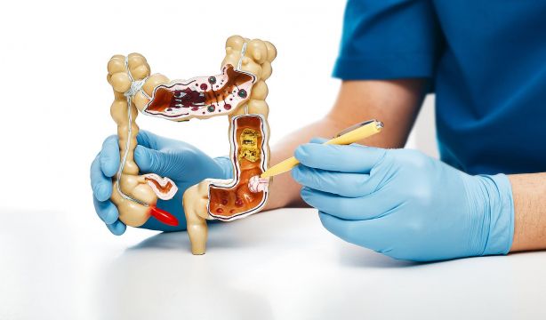 ¿Adiós a la colonoscopia? Llegan unas píldoras que detectan enfermedades intestinales