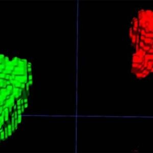 Segmentación 3D automatizada de las glándulas suprarrenales izquierda y derecha en TC de tórax. (Dra. Elena Ghotbi y RSNA) Segmentación 3D automatizada de las glándulas suprarrenales izquierda y derecha en TC de tórax. (Dra. Elena Ghotbi y RSNA)