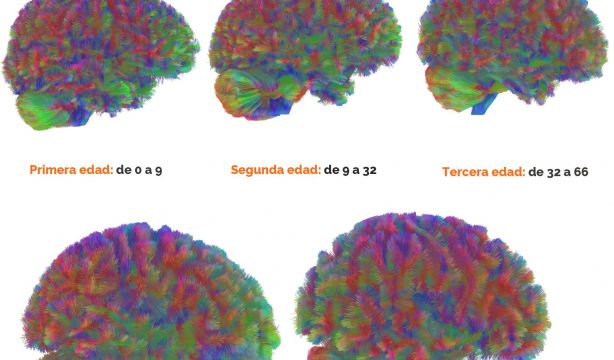 Edades Cerebro. Dr Alexa Mousley, University of Cambridge 