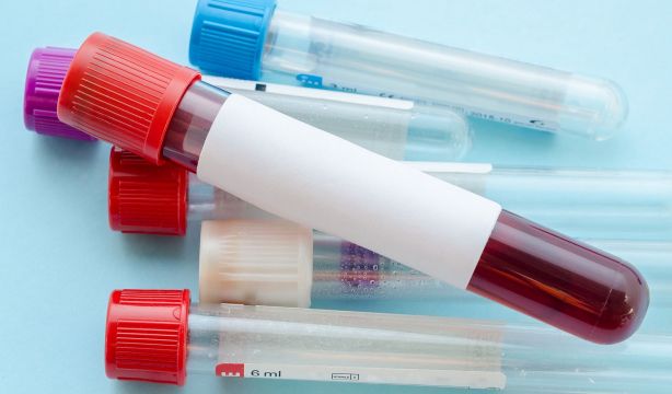 El VIH avanza hacia un futuro sin transmisión gracias a la innovación médica