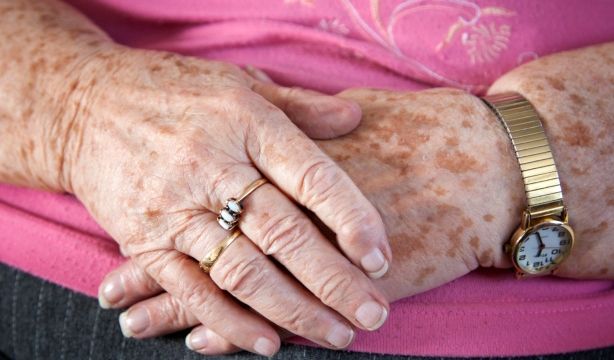 Hablando en plata: léntigos solares