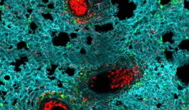 EuropaPress 7145811 neutrofilos rojo acumulan alveolos pulmon infectado gripe EuropaPress 7145811 neutrofilos rojo acumulan alveolos pulmon infectado gripe