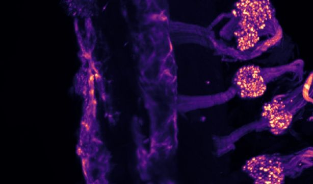 Así es el mapa oculto del frío en el cuerpo humano: sensores en la piel y en los órganos internos Foto: Europa Press.