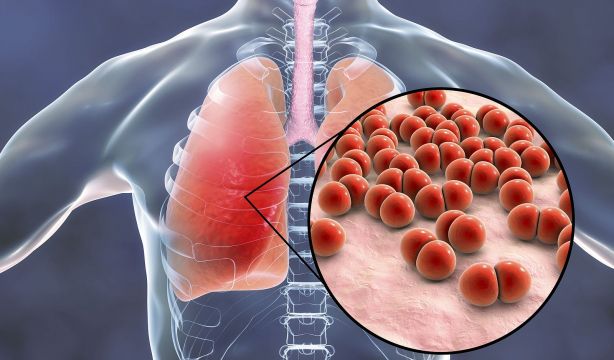 Estudio revela nuevos datos sobre la acción de los antibióticos frente al neumococo y su resistencia